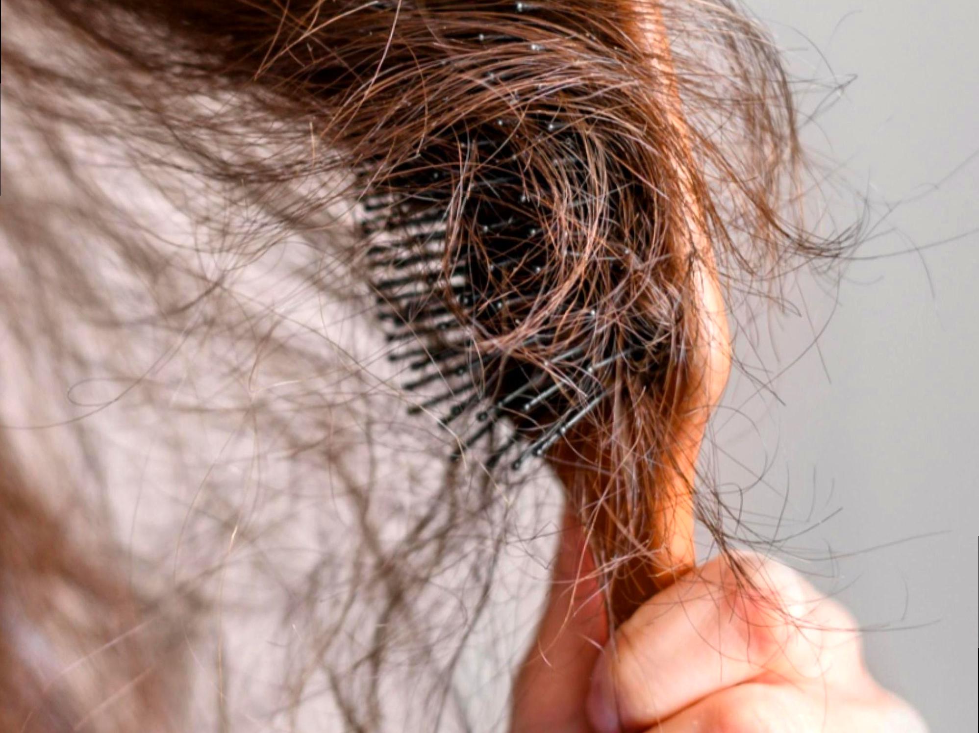 Missteps in Hair Care and Effective Fixes