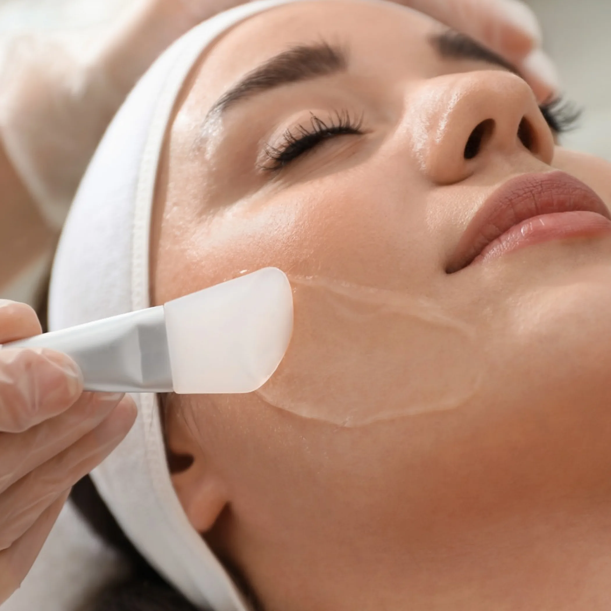 professional chemical peel treatment